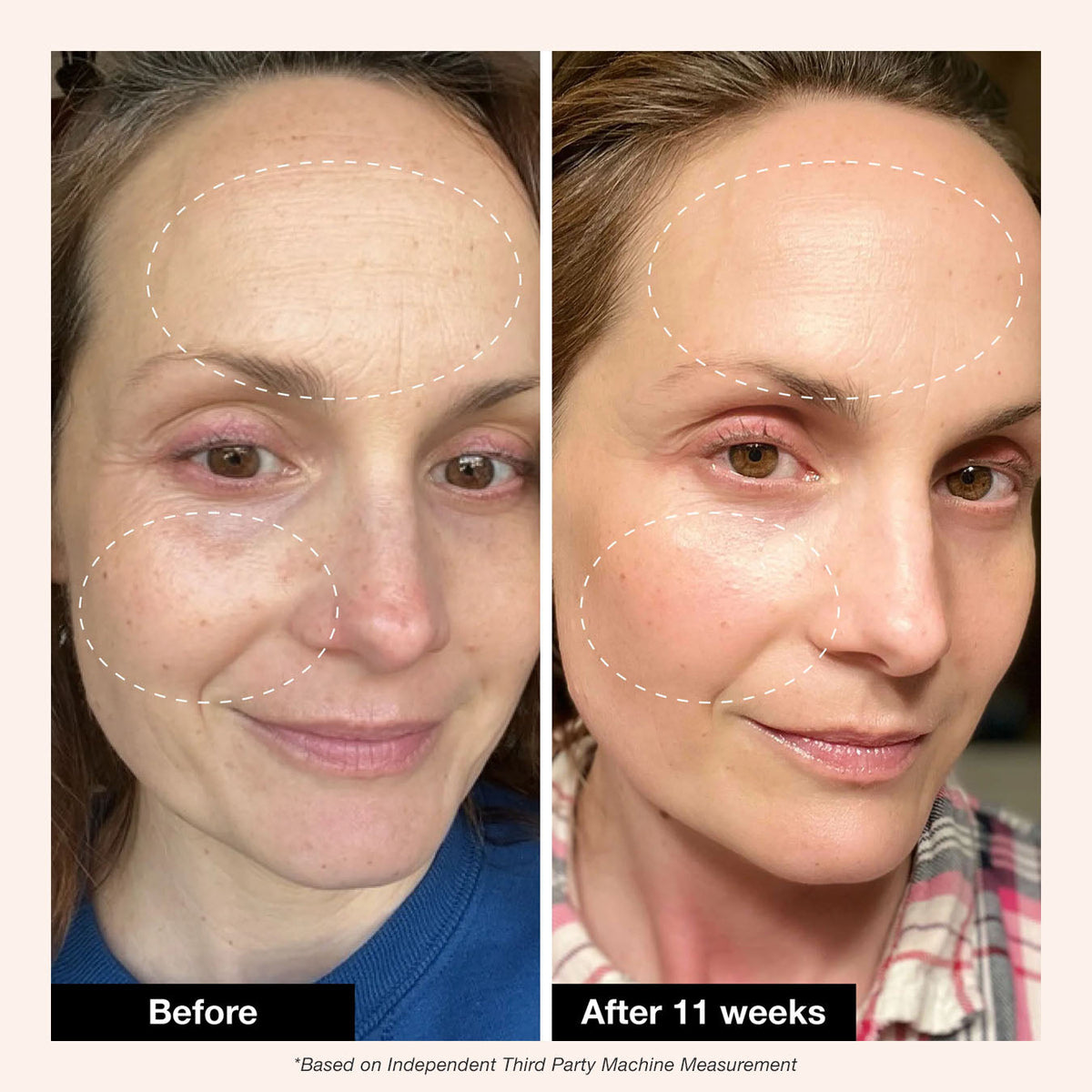 Retinol Revival