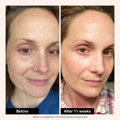 Retinol Revival