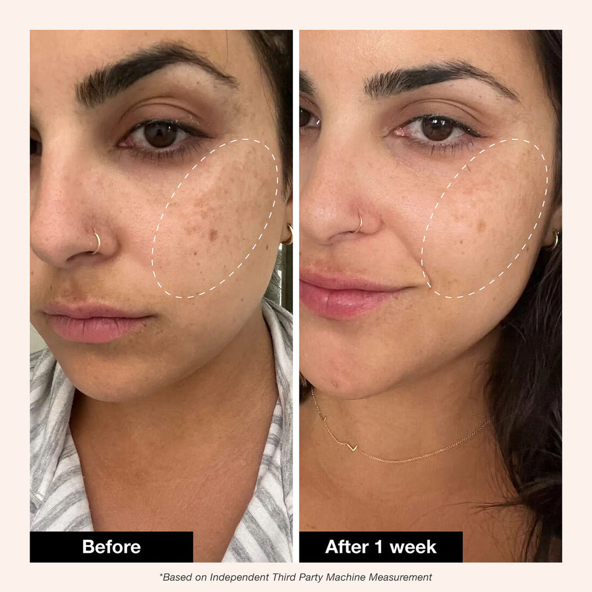 Retinol Revival