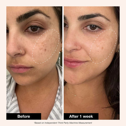 Retinol Revival